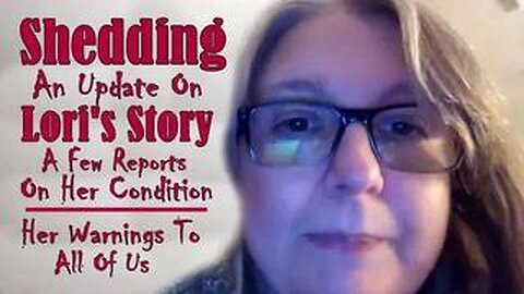 Shedding Is Real! - Lori Gives Us An Update