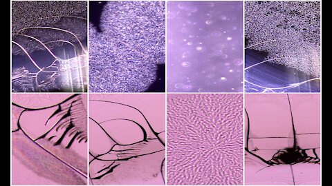 Janssen vaccine under light microscopy