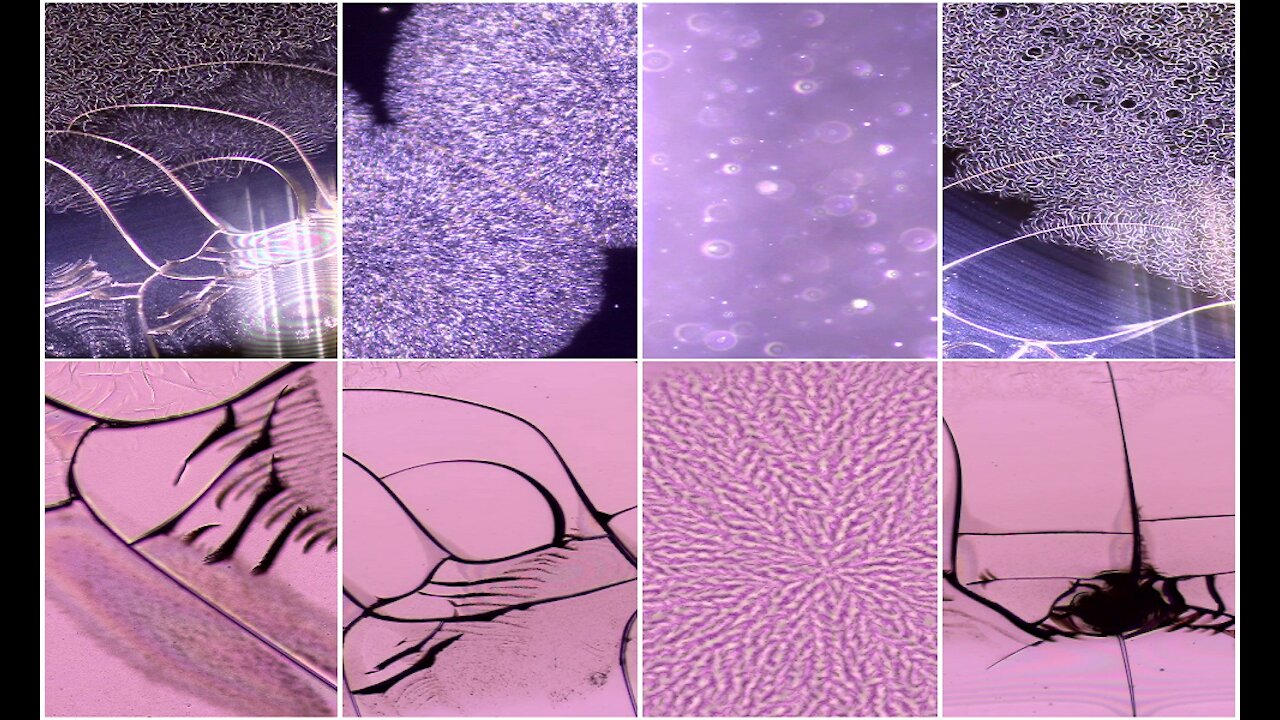 Janssen vaccine under light microscopy