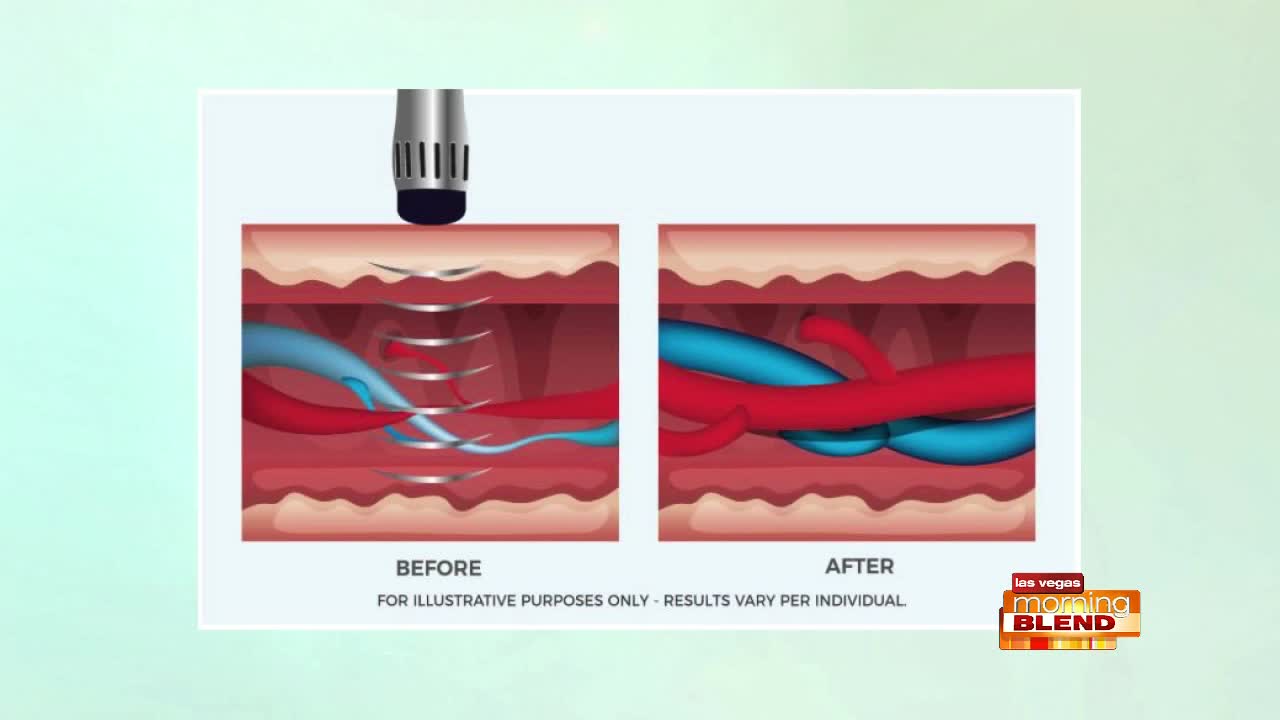 New Treatment for E.D.