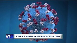 Lucas County Health Department investigating possible measles case in Toledo area