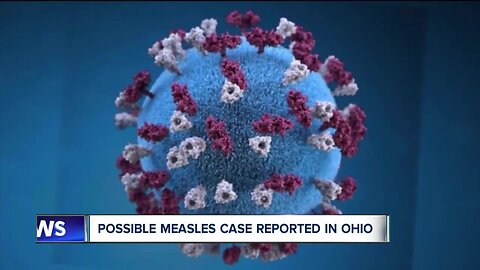 Lucas County Health Department investigating possible measles case in Toledo area