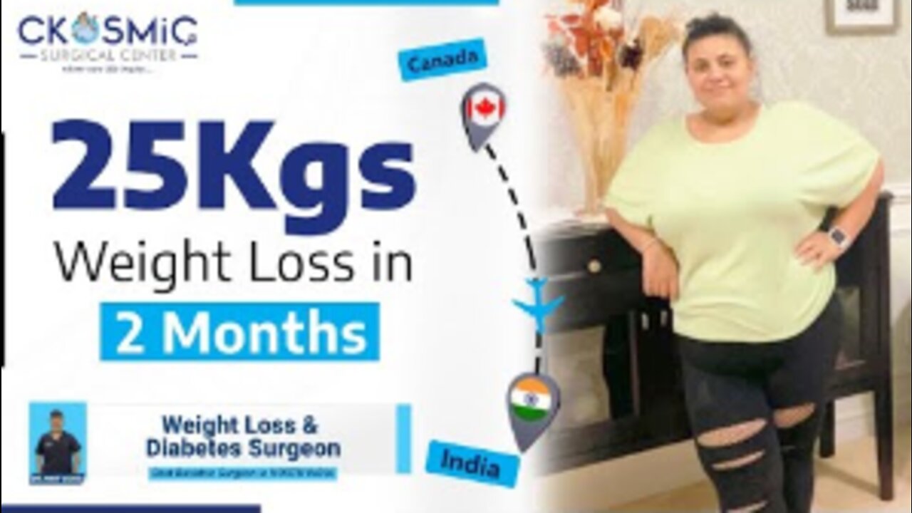 Mini Gastric Bypass Surgery for Weight Loss