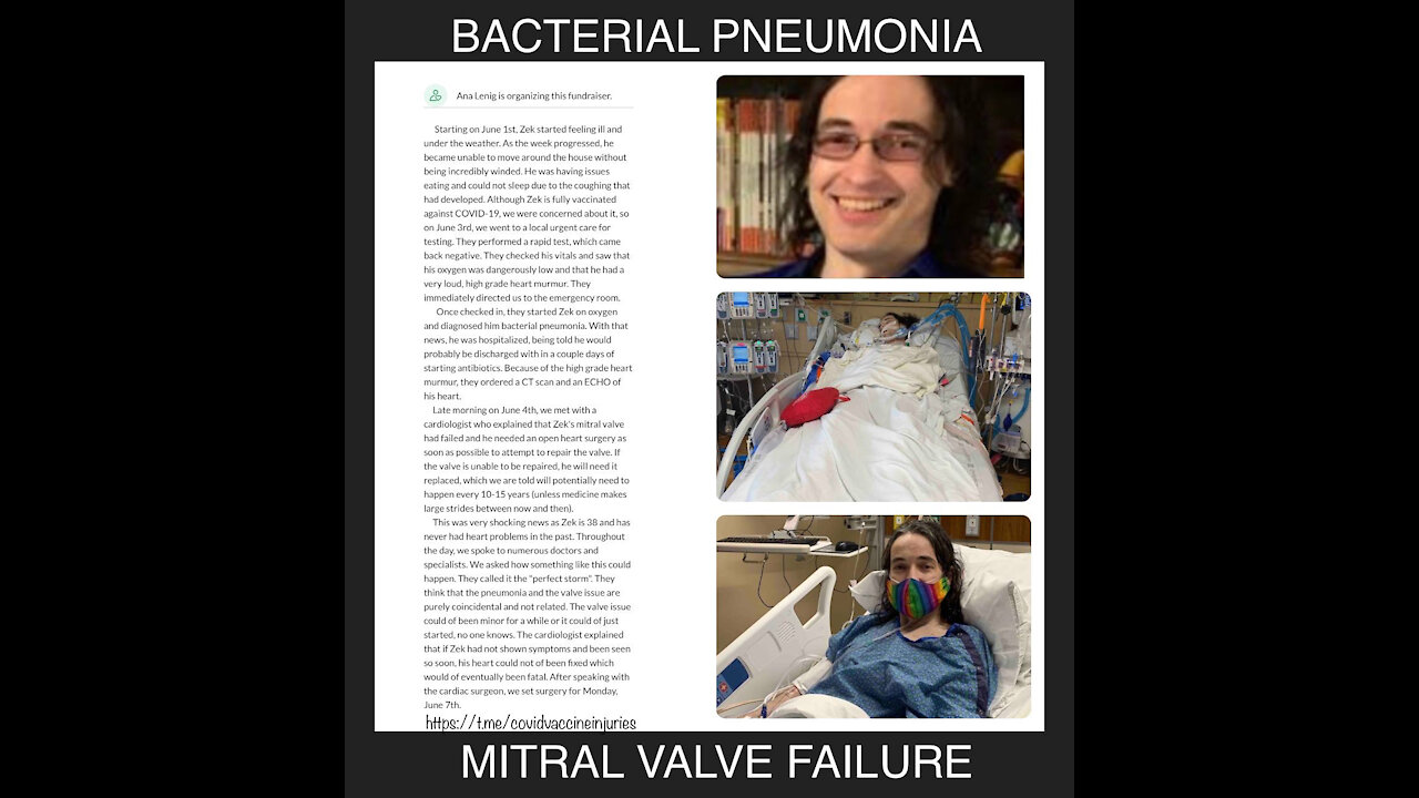 Dead From The Covid-19 Shot