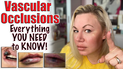 Vascular Occlusions : Everything YOU Need to Know | Code Jessica10 saves you $ at Approved Vendors