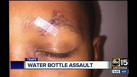 Mom: 6-year-old son badly hurt in incident at Tempe school