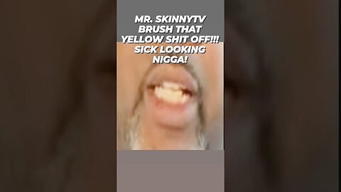 DAMM SKINNY BRUSH THAT YELLOW OFF YOUR TEETH!!