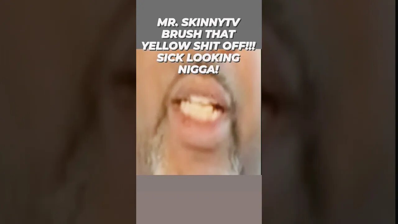 DAMM SKINNY BRUSH THAT YELLOW OFF YOUR TEETH!!