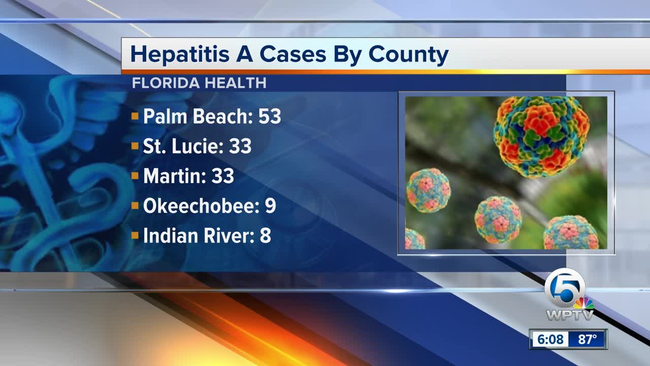New cases of Hepatitis A in South Florida