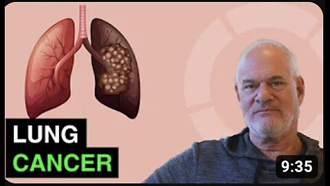 Dr. 'Mark Sircus' : Lung Cancer - How to Treat Naturally in 2021