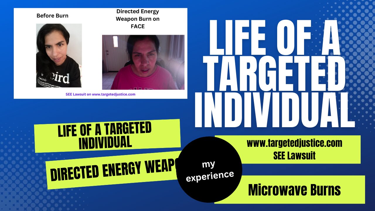 Directed Energy Weapons on Face -Targeted Individual