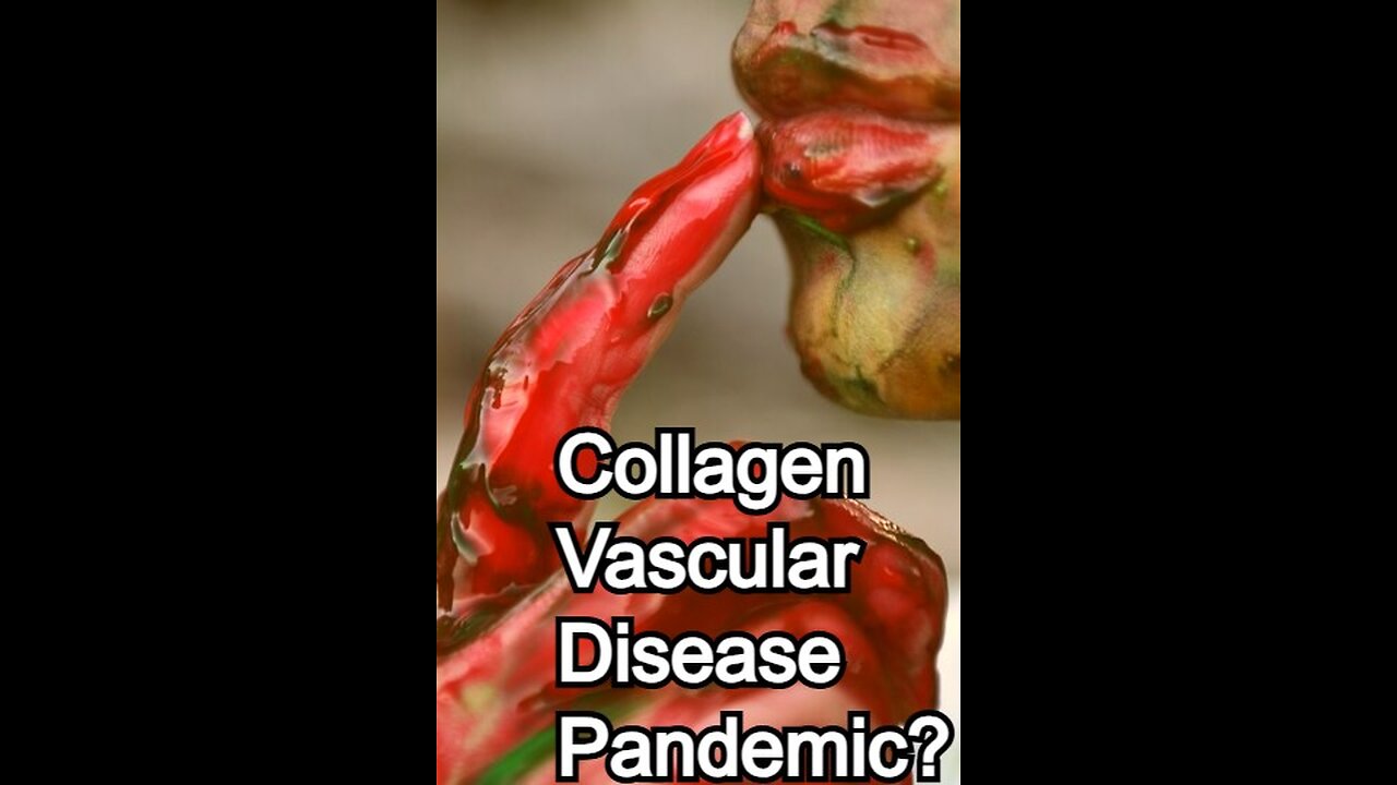 Collagen-vascular Diseases Pandemic?