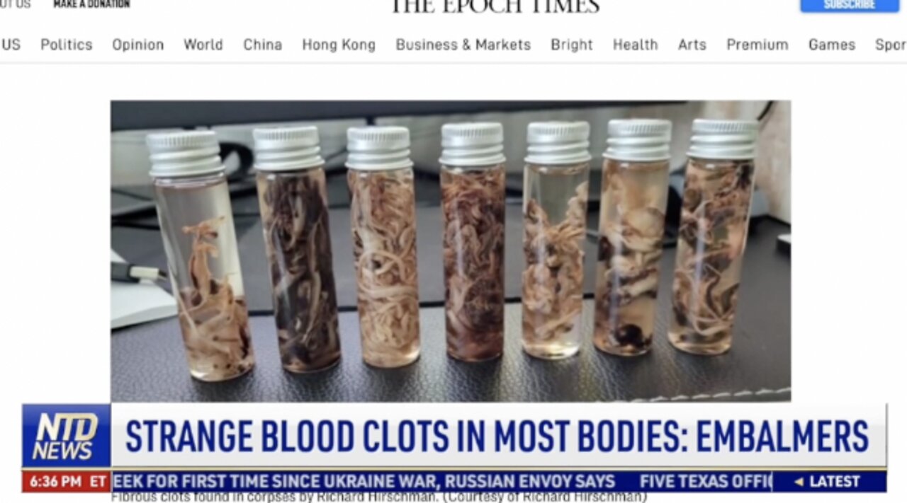 Embalmers: Strange New Blood Clots in Most Bodies