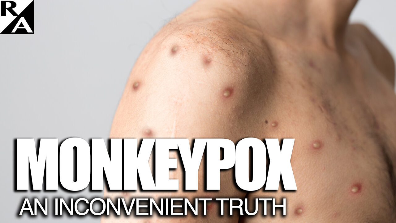 Monkeypox: An Inconvenient Truth (This Video Is Not on YouTube)