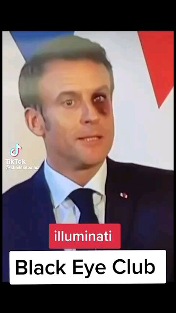 Is there a such thing as 'Black Eye Club' in the Elite