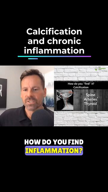 Calcification means long-term inflammation