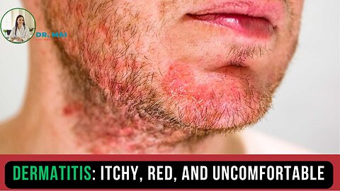 What is the Main Cause of Dermatitis? | DR. MAI