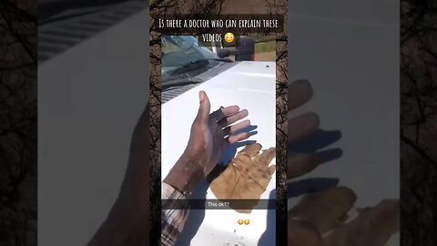 His hand just did WHAT?!