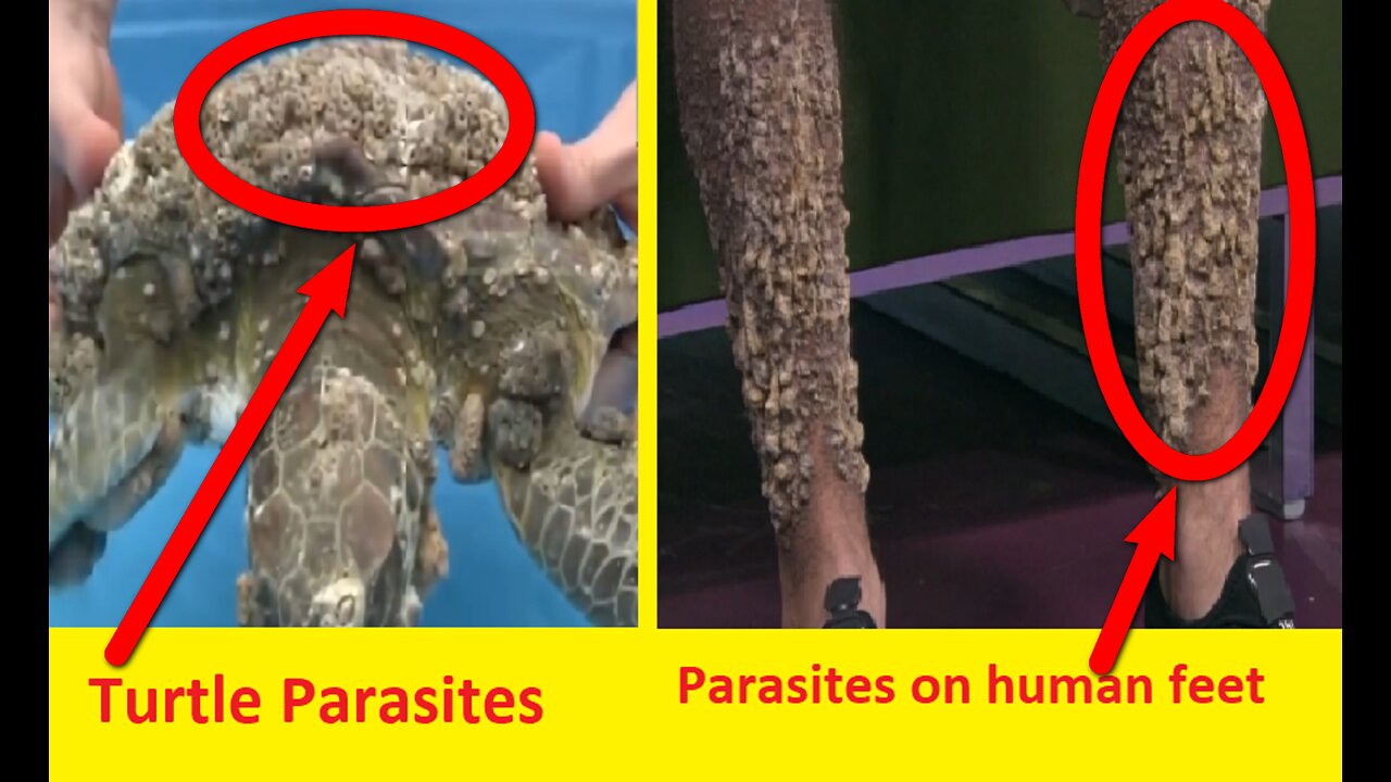 Human legs are eaten by parasites scabs.