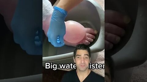 Very Big Blister