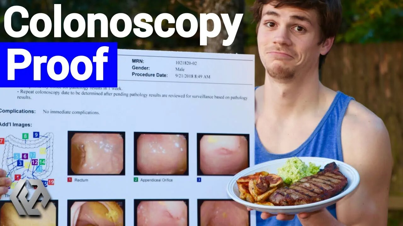 IBD Clinical Remission | What I Ate to Recover From Ulcerative Colitis