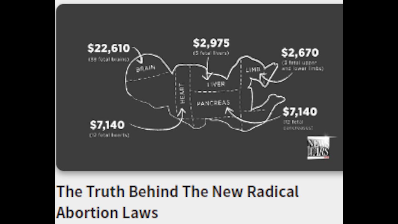 The Truth Behind The New Radical Abortion Laws-Babies are worth more in pieces