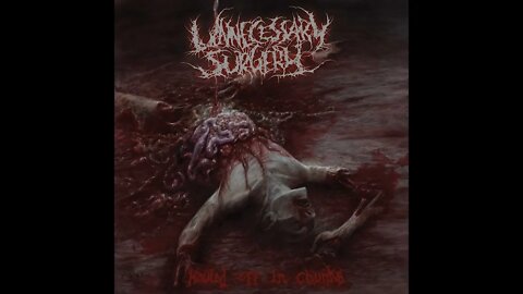 Unnecessary Surgery - Hauled Off In Chunks (Full Demo)