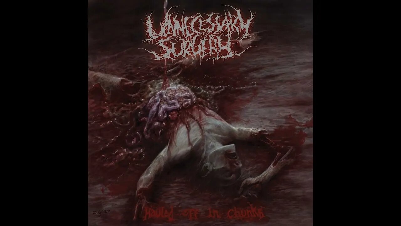 Unnecessary Surgery - Hauled Off In Chunks (Full Demo)