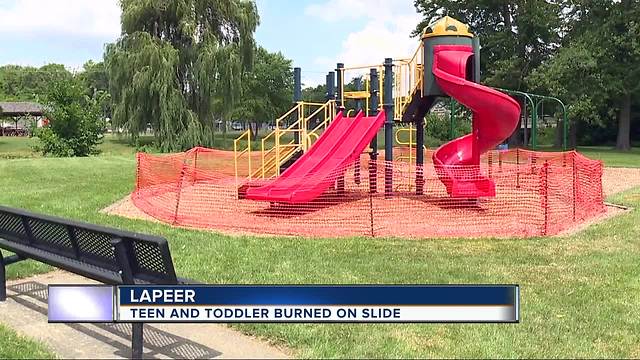 Two kids suffer chemical burns from slide at Lapeer park