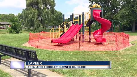 Two kids suffer chemical burns from slide at Lapeer park