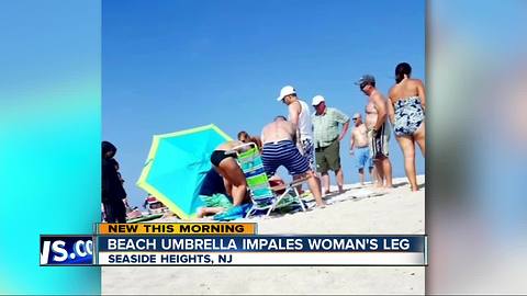 Woman's leg impaled by flying beach umbrella