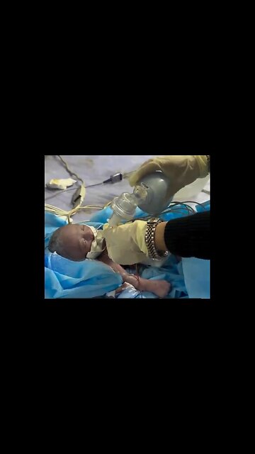 Premature Baby Being Resuscitated After Her Mother Was Killed By Netanyahu and His Regime [HYM]