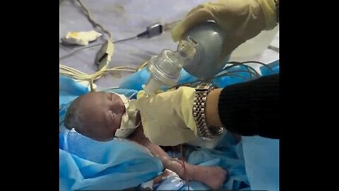 Premature Baby Being Resuscitated After Her Mother Was Killed By Netanyahu and His Regime [HYM]