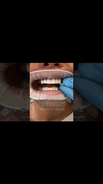 Dental And Teeth Hygiene