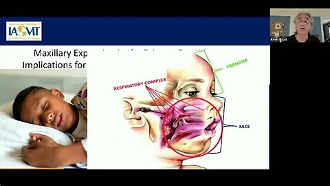 Kevin Boyd, DDS does a virtual presentation " Maxillary Expansion in the Primary Dentition."