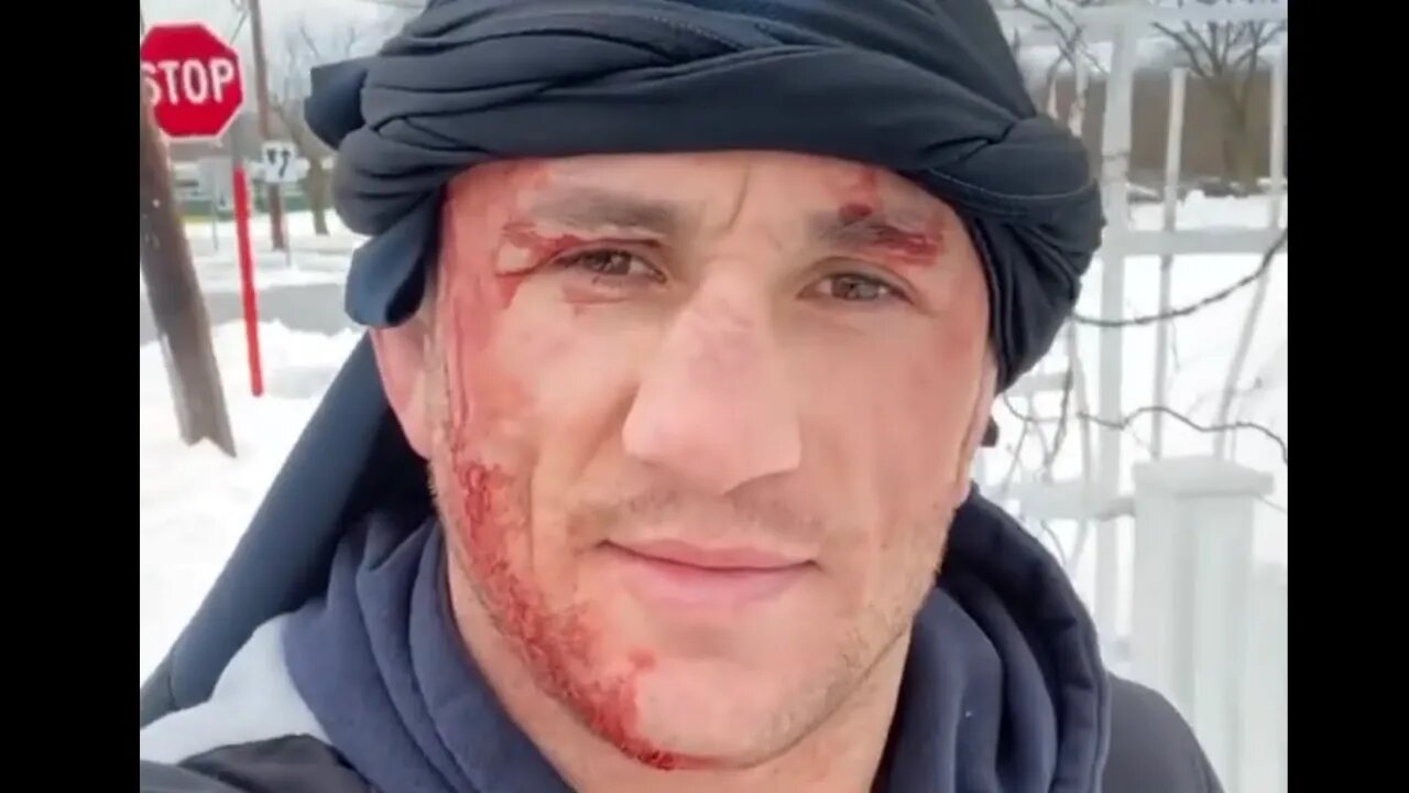 UFC fighter Merab Dvalishvili dives into frozen pond splits head open needs staples