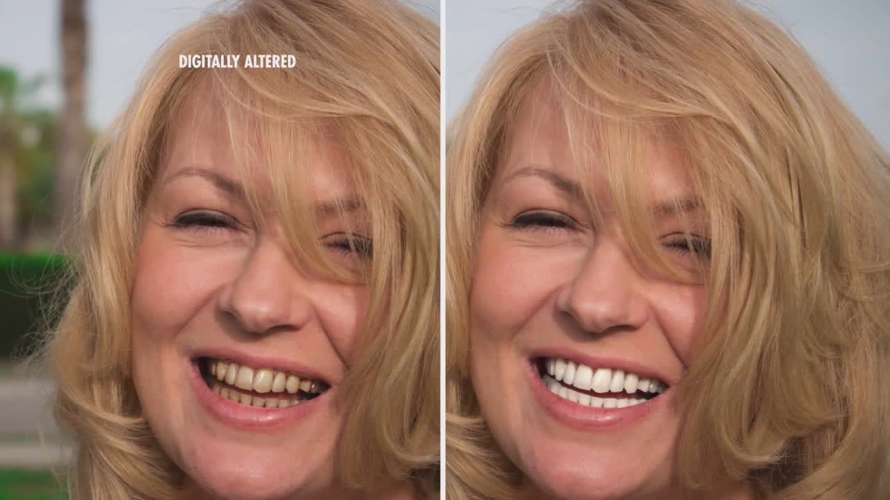 Whiten Your Teeth With Ease