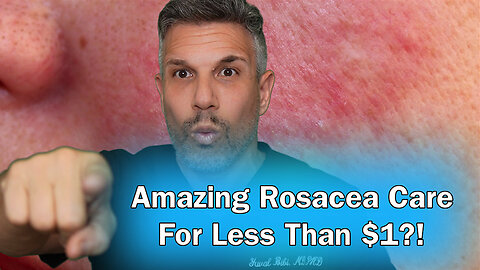 Amazing Rosacea Skincare For Less Than $1?!