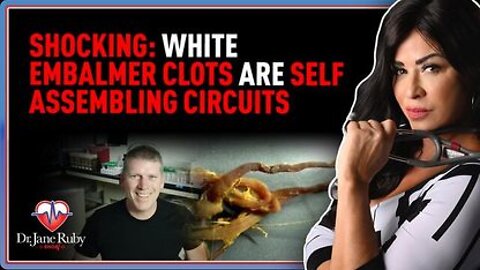SHOCKING - White Embalmer Clots Are Self Assembling Circuits