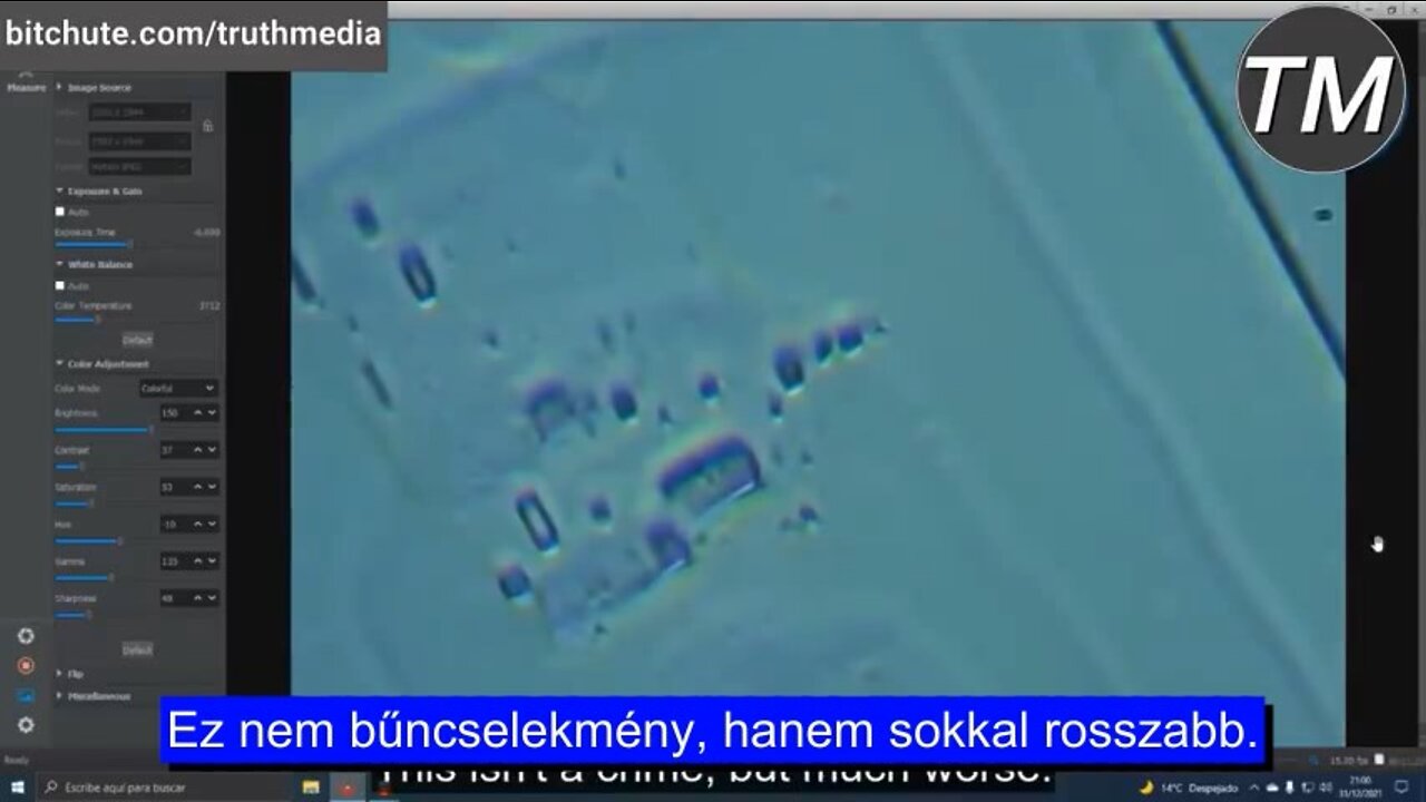Mikro-routert találtak a Pfizer-oltásban