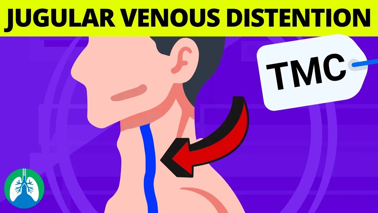 What are the Causes of Jugular Venous Distention (JVD)? | TMC Practice Question