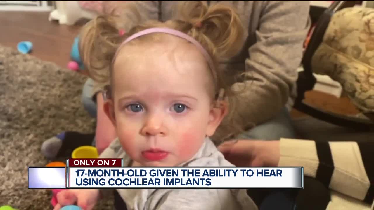 Toddler given the ability to hear using cochlear implants