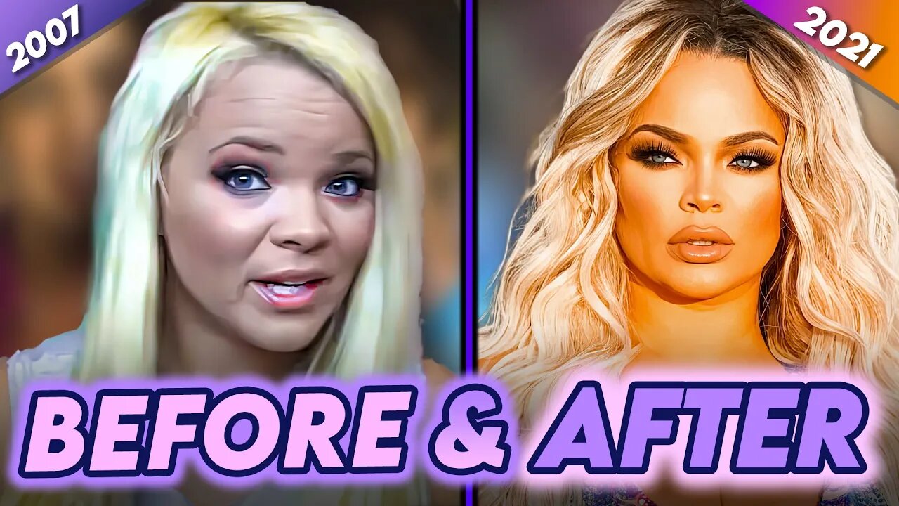 Trisha Paytas | Before & After | Plastic Surgery, Liposuction, Hairstyle & More