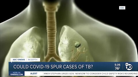 SDSU researcher warns COVID-19 could cause spike in tuberculosis cases