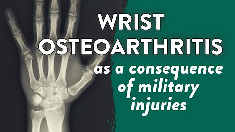 Wrist osteoarthritis as a consequence of military injuries