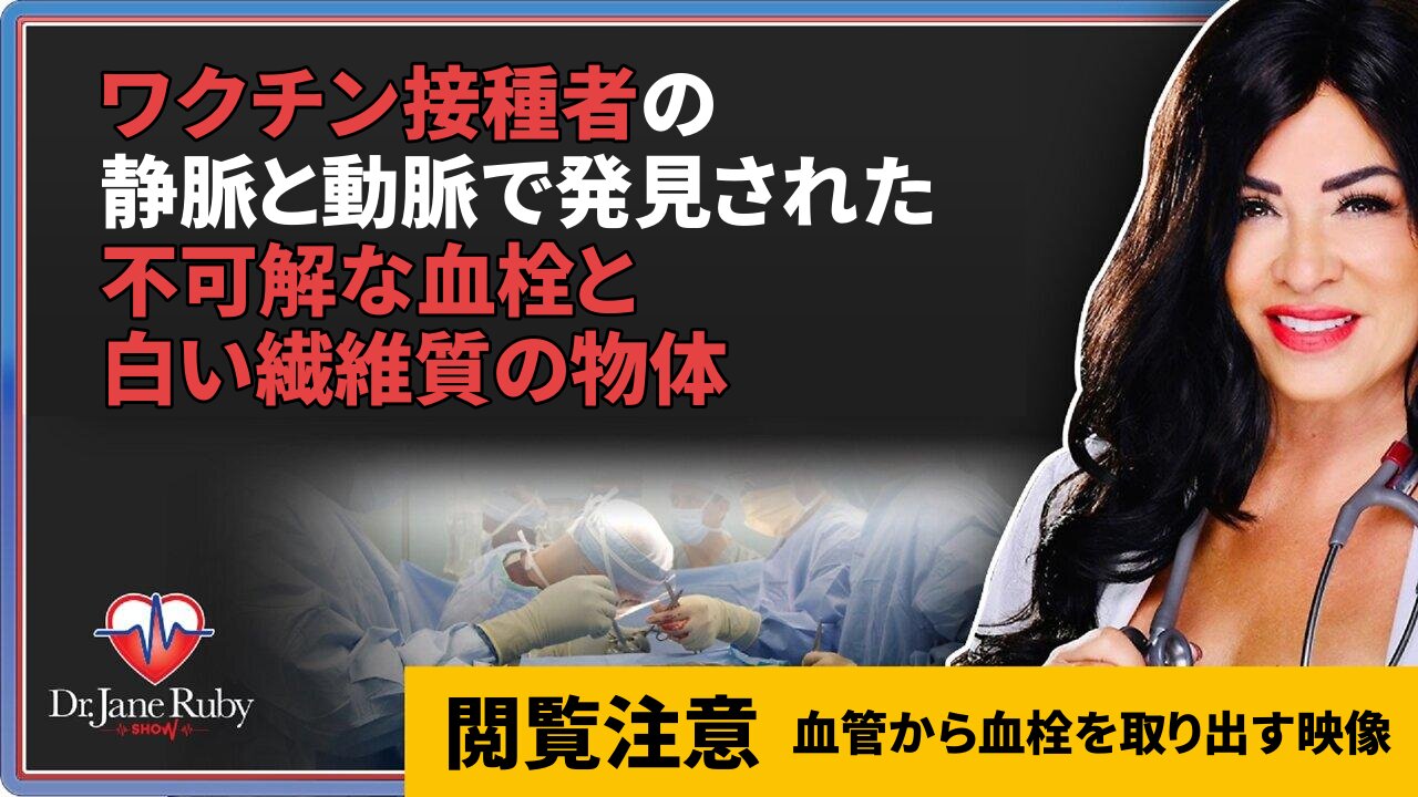 【閲覧注意】ワクチン接種者の静脈と動脈で発見された不可解な血栓と白い繊維質の物体 Richard Hirschman Dr Jane Ruby 2022/01/31