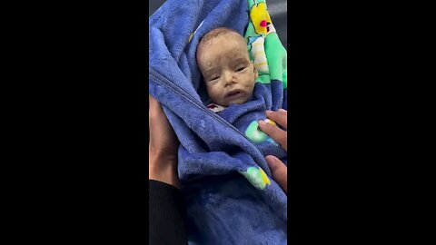 A 6-month-old baby died this morning at the Al-Ahli Hospital in Gaza City. lack of medicine ⏬⏬descp