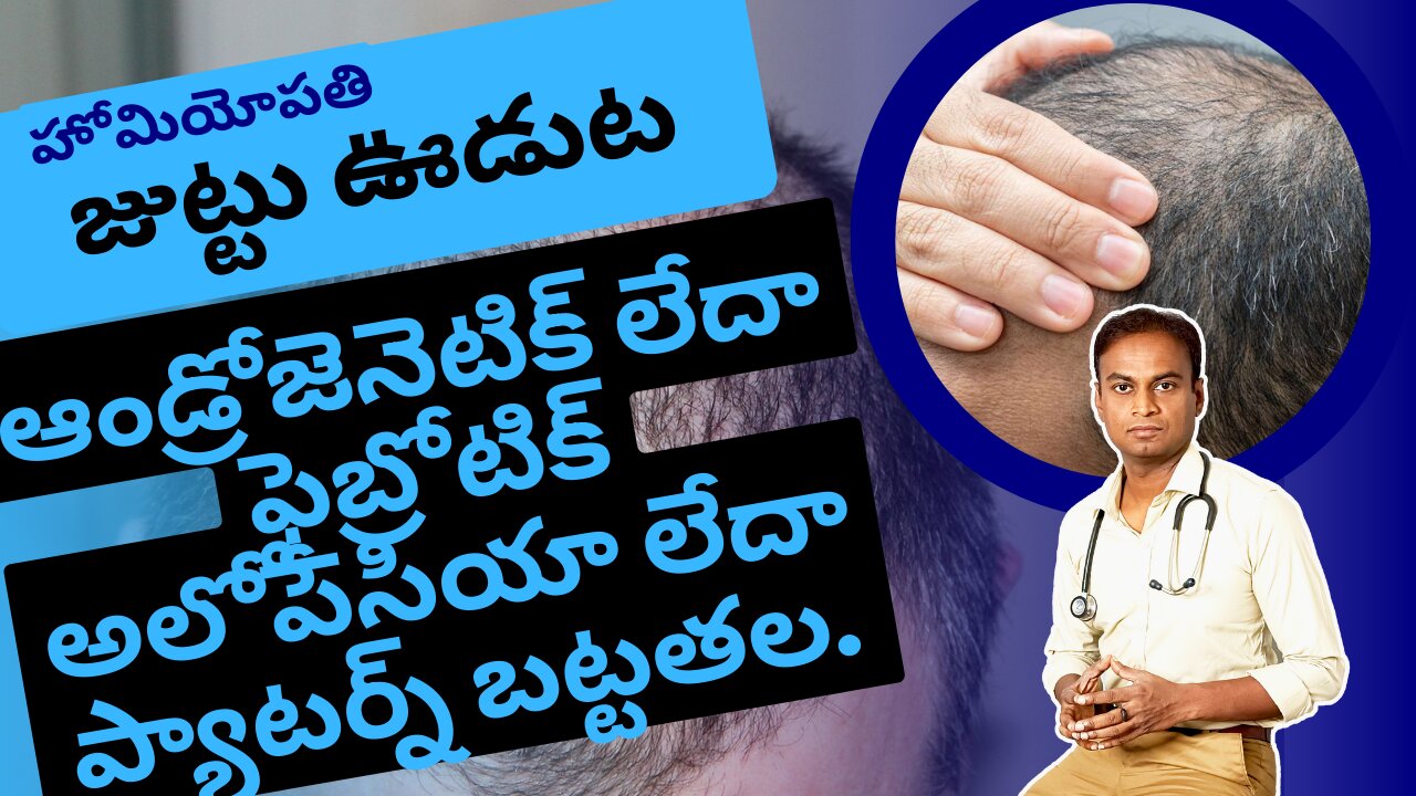 పాటర్న్ బట్టతల హోమియోపతి చికిత్స .Dr. Bharadwaz | Homeopathy, Medicine & Surgery