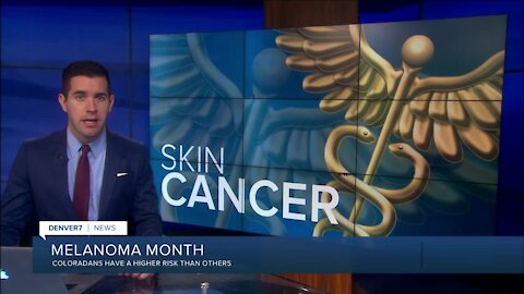 Self-exams can be critical in spotting melanoma, other skin cancers