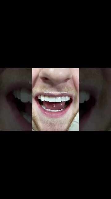 Dental And Teeth Hygiene